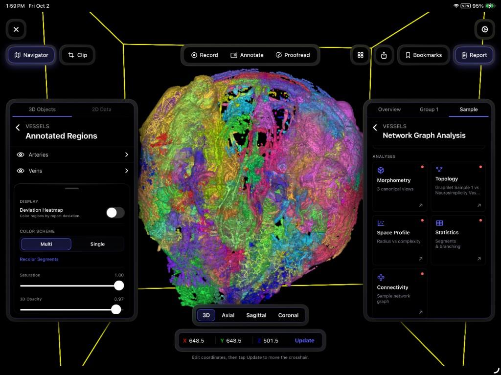 NeuroSimplicity Mouse Vessel Atlas labels on micro-CT vasculature in native sample space