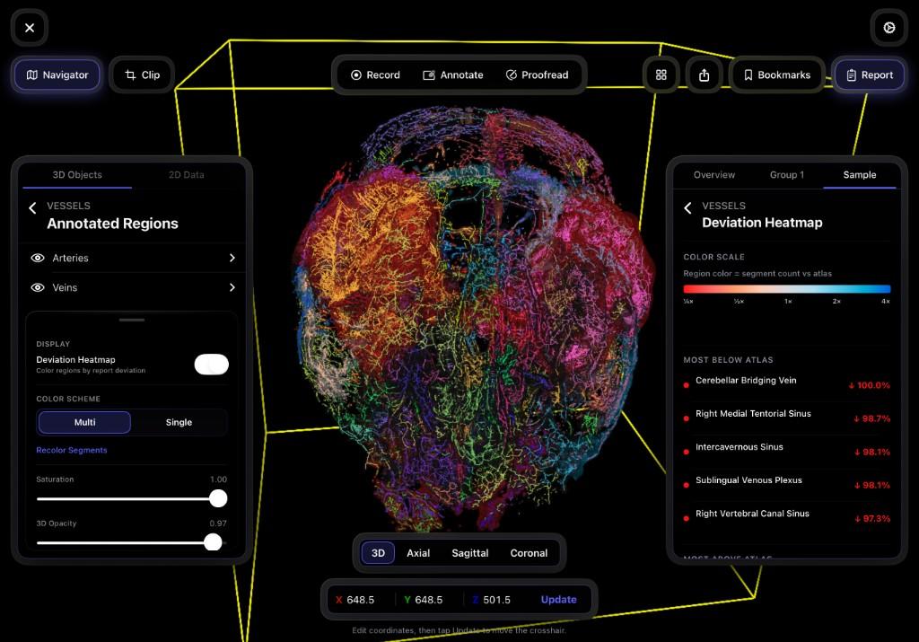 Whole-cranium vascular deviation heatmap in native sample space with report metrics