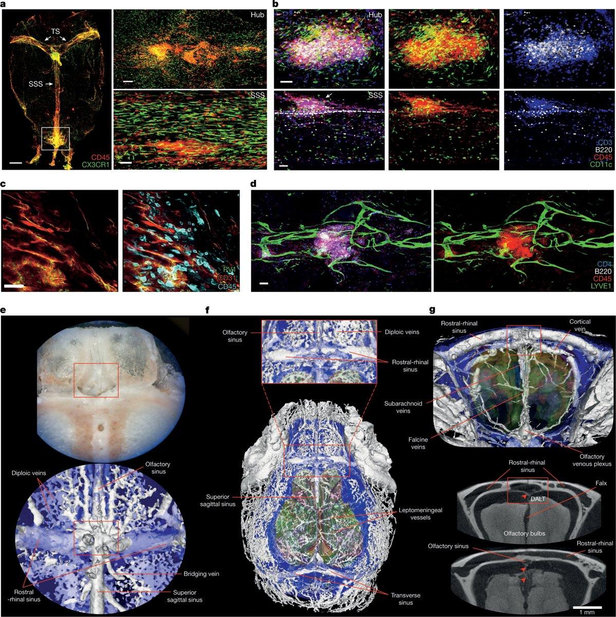 Brain, skull, and meningeal anatomy in native specimen space