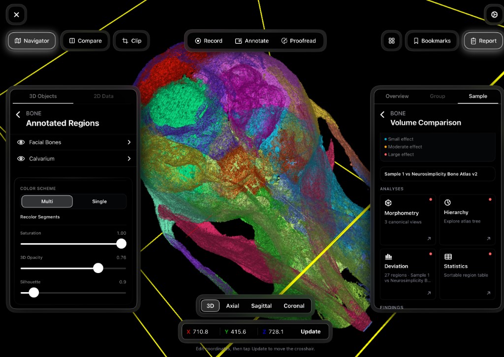 Bone regional volume analysis with annotated skull regions