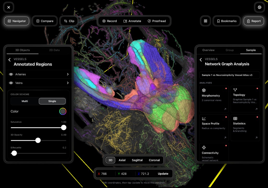 Annotated neurovascular network graph analysis in the Imaging Suite