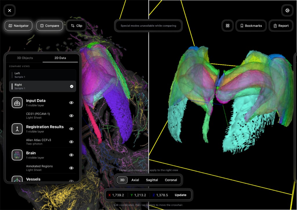 Side-by-side cohort comparison in native sample space — NeuroSimplicity Imaging Suite