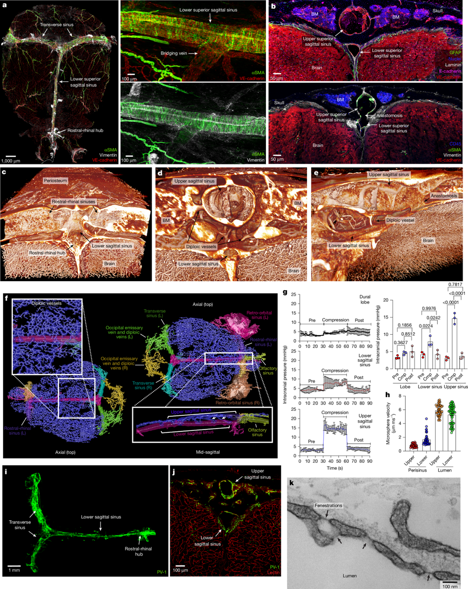 Cranial vasculature mapping from Nature (2026) — dural sinuses and meningeal immunity at the brain border